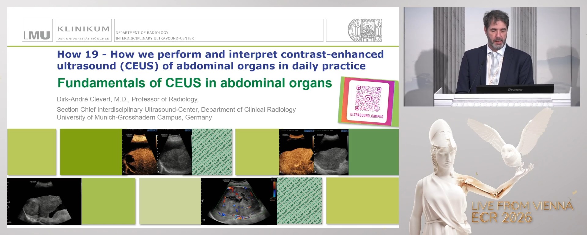 Fundamentals of CEUS in abdominal organs