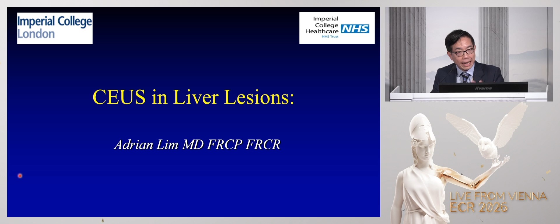 CEUS in liver lesions