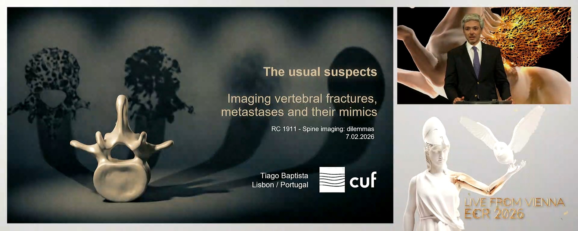 The usual suspects: imaging vertebral fractures, metastases and their mimics