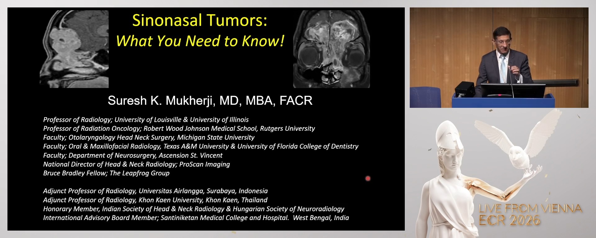 Sinonasal tumours: what you need to know