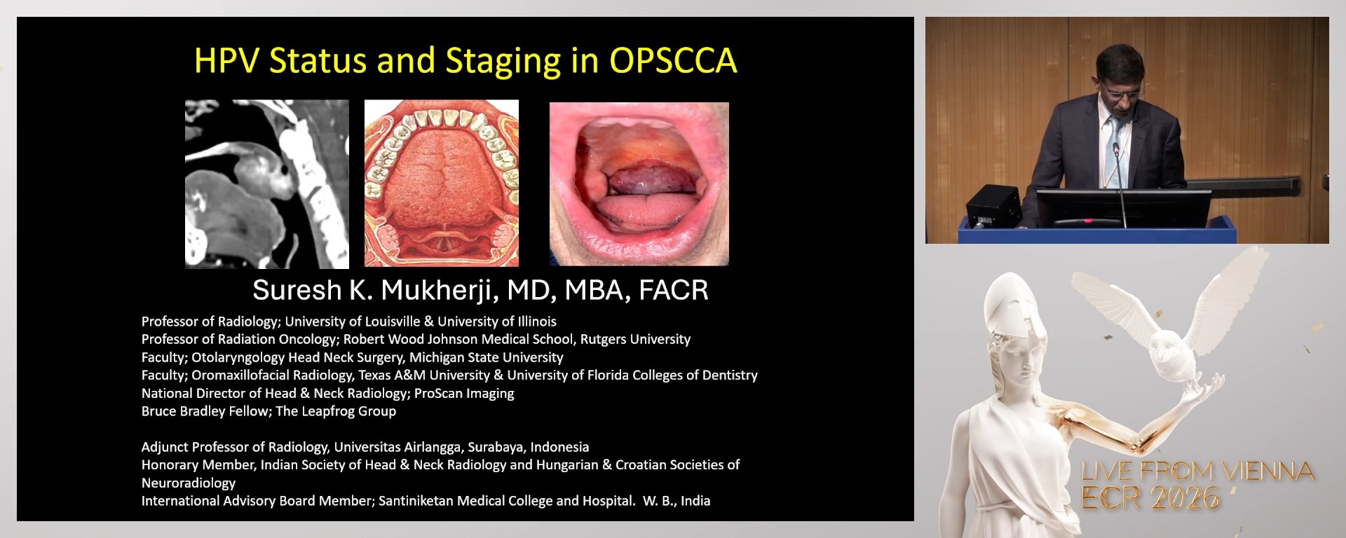 HPV status and staging in oropharyngeal carcinoma