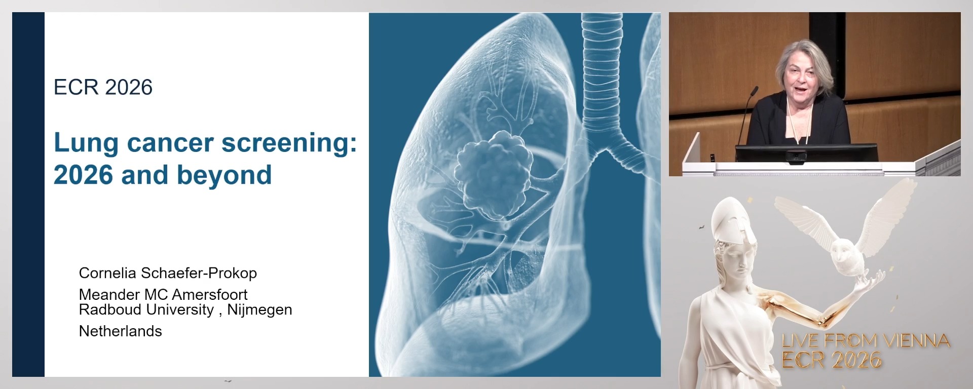 Lung cancer screening: 2026 and beyond
