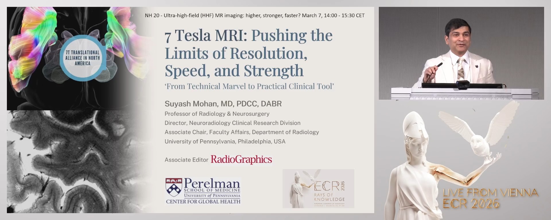 7 Tesla MRI: pushing the limits of resolution, speed, and strength