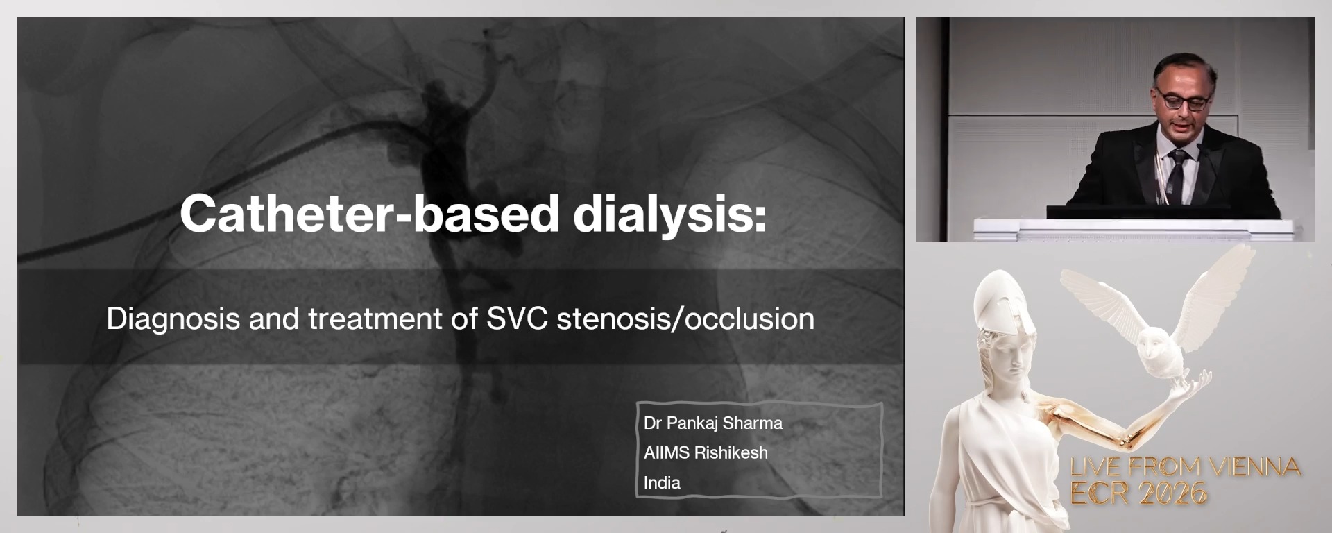 Catheter-based dialysis: diagnosis and treatment of SVC stenosis/occlusion