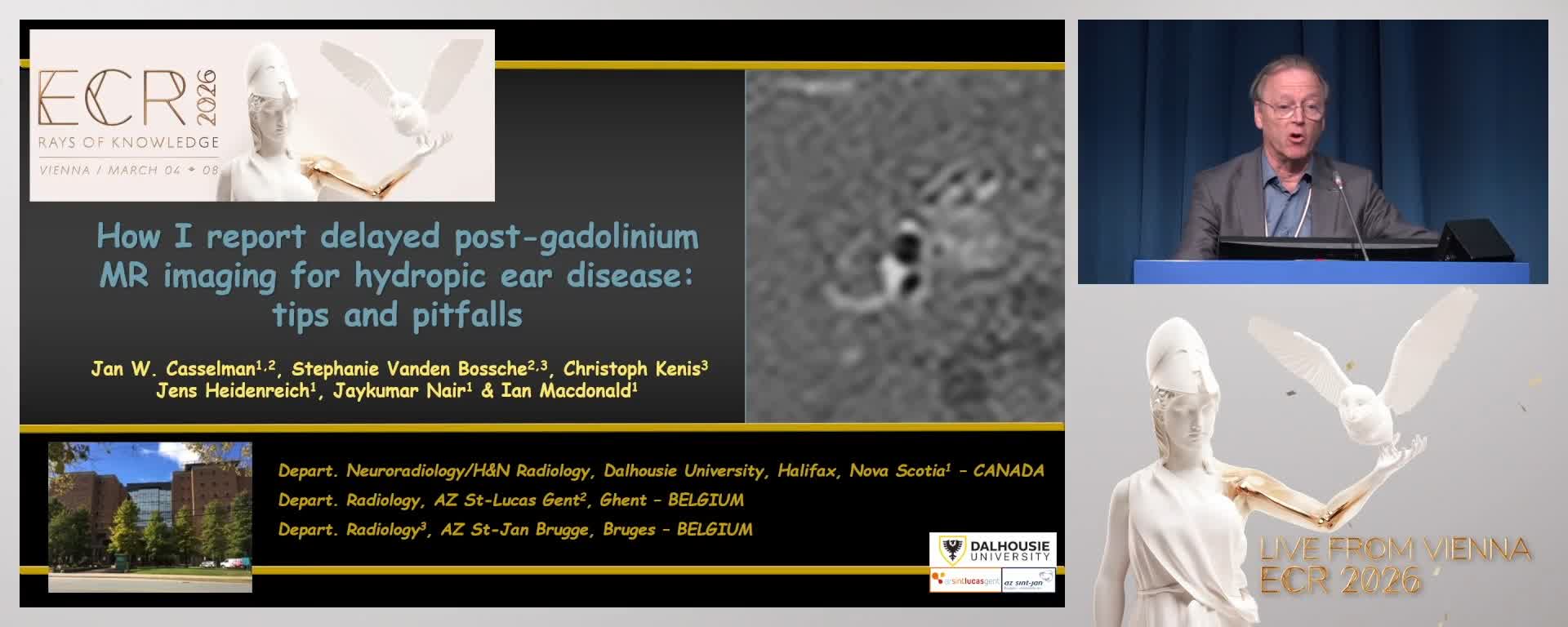 How I report delayed post-gadolinium MR imaging for hydropic ear disease: tips and pitfalls