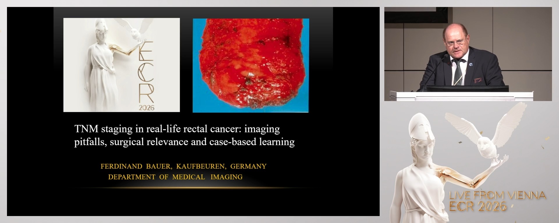 Interactive case-based learning: applying TNM to real cases
