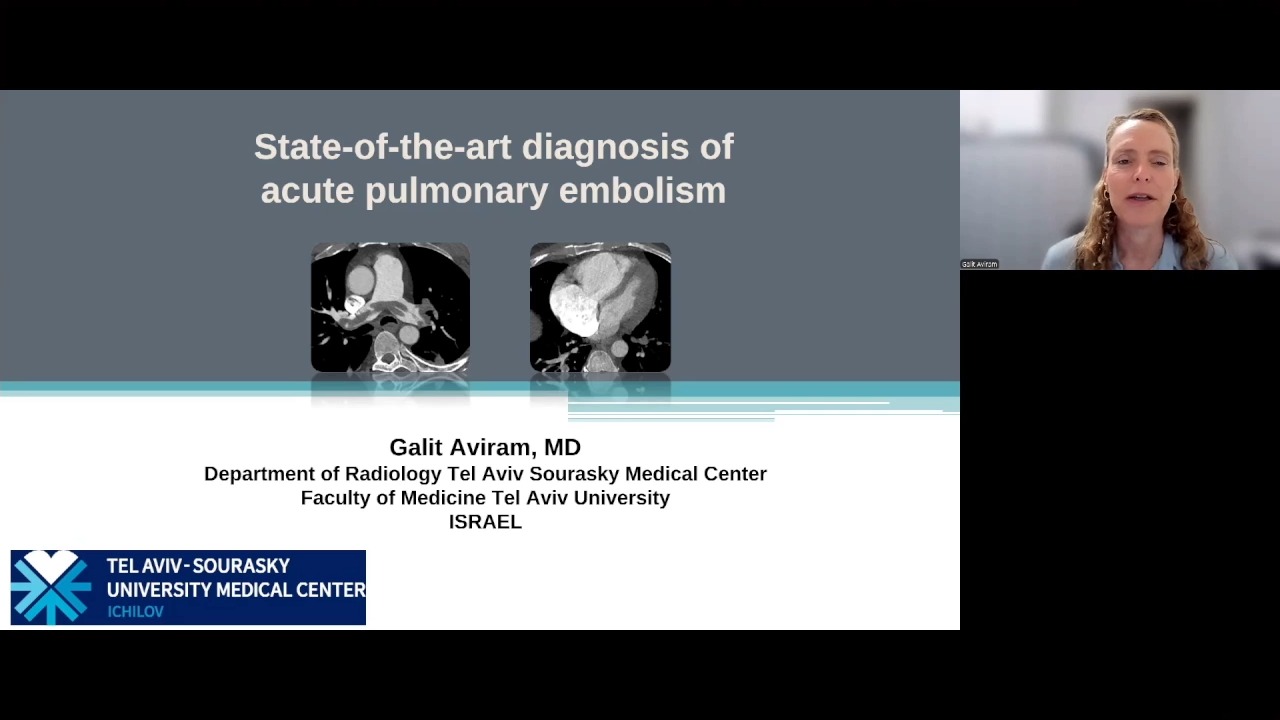 State-of-the-art diagnosis for pulmonary embolism (PE)