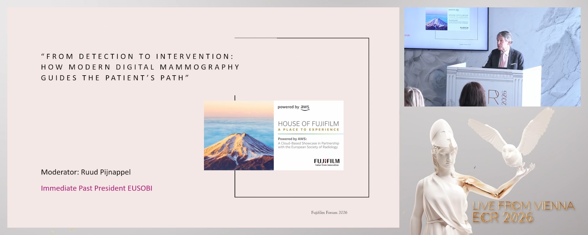 From detection to intervention: how modern digital mammography guides the patient’s path (Complete Session)