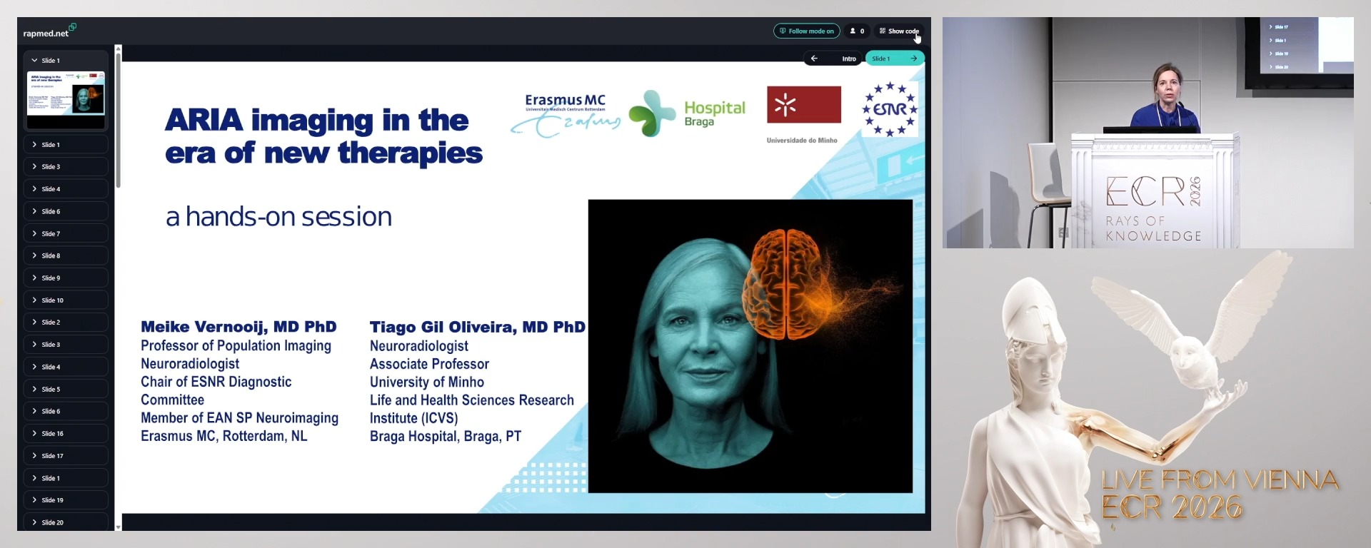 ARIA Imaging in the era of new therapies (Complete Session)